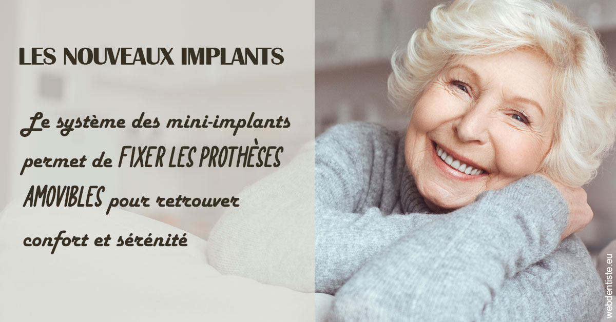 https://dr-aubry-marie-pierre.chirurgiens-dentistes.fr/Les nouveaux implants 1