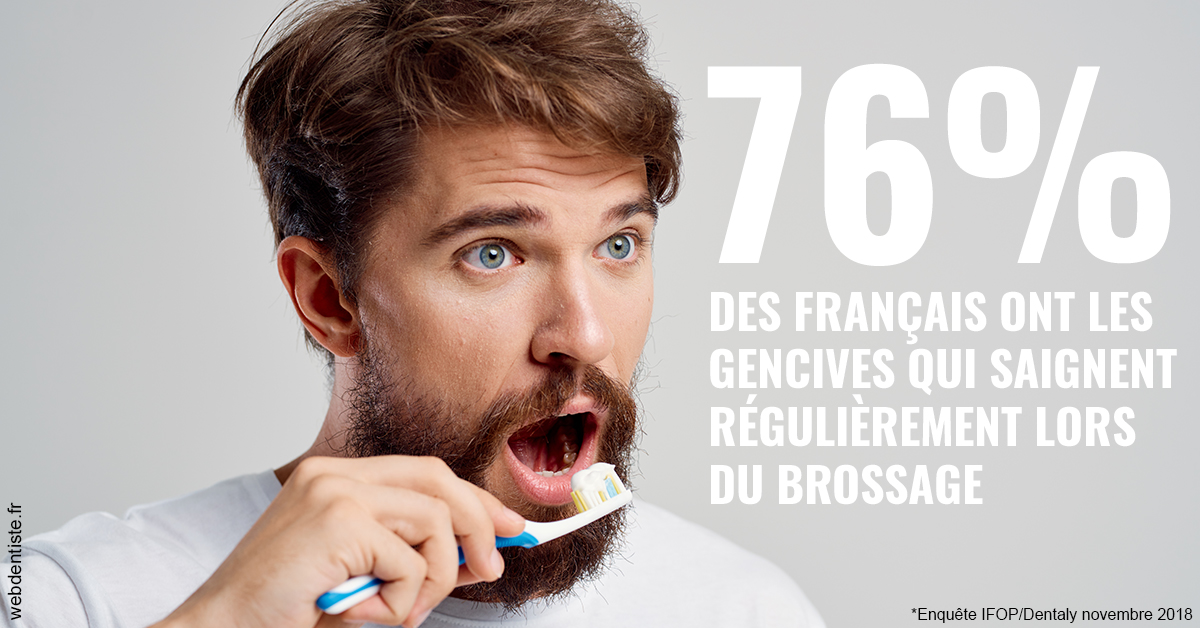 https://dr-aubry-marie-pierre.chirurgiens-dentistes.fr/76% des Français 2