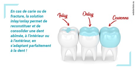 https://dr-aubry-marie-pierre.chirurgiens-dentistes.fr/L'INLAY ou l'ONLAY