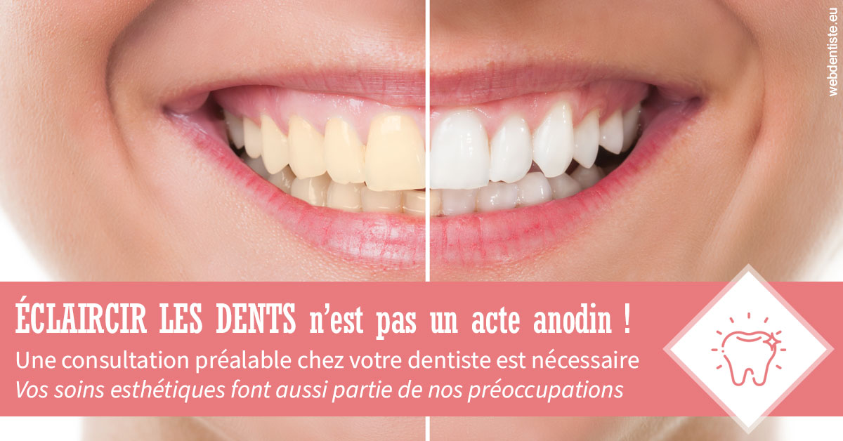 https://dr-aubry-marie-pierre.chirurgiens-dentistes.fr/Eclaircir les dents 1