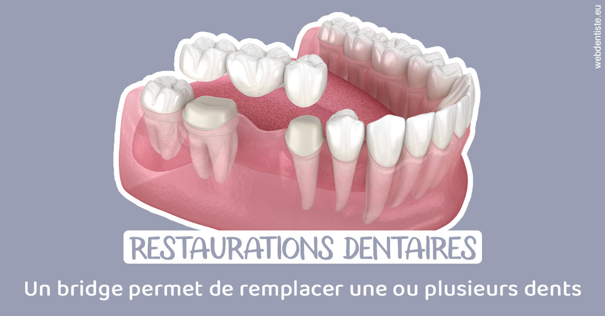 https://dr-aubry-marie-pierre.chirurgiens-dentistes.fr/Bridge remplacer dents 1