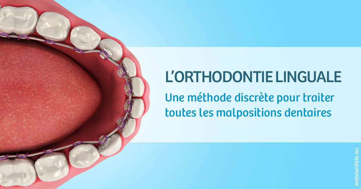 https://dr-aubry-marie-pierre.chirurgiens-dentistes.fr/L'orthodontie linguale 1