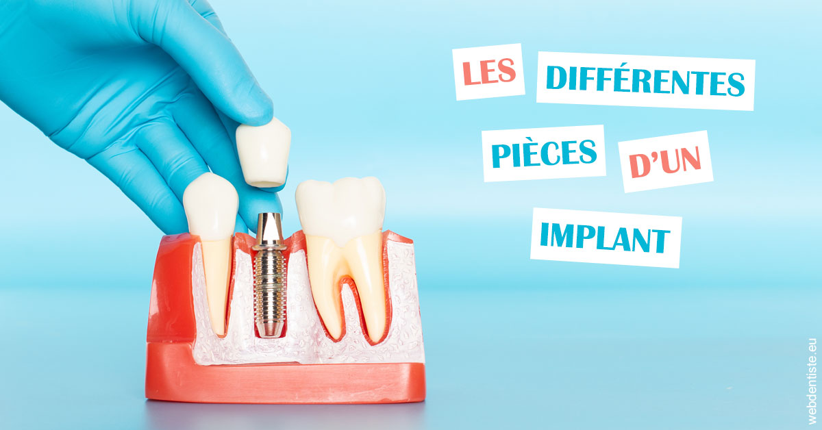 https://dr-aubry-marie-pierre.chirurgiens-dentistes.fr/Les différentes pièces d’un implant 2