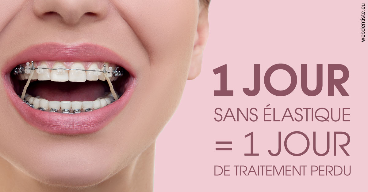 https://dr-aubry-marie-pierre.chirurgiens-dentistes.fr/Elastiques 2