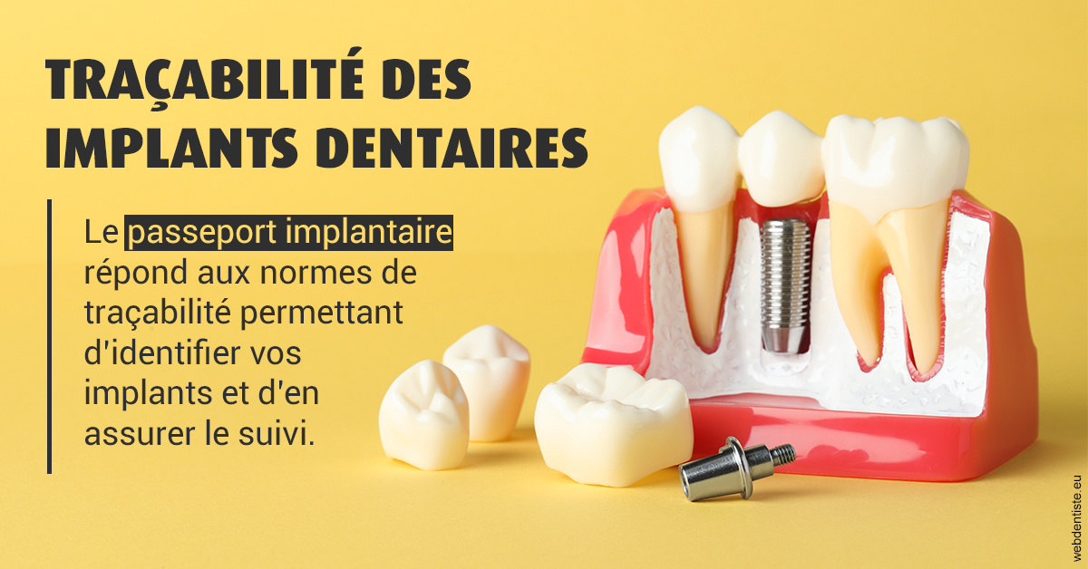 https://dr-aubry-marie-pierre.chirurgiens-dentistes.fr/T2 2023 - Traçabilité des implants 2