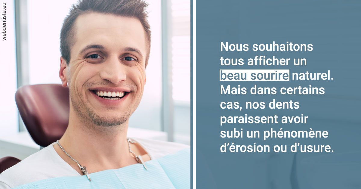 https://dr-aubry-marie-pierre.chirurgiens-dentistes.fr/Érosion et usure dentaire