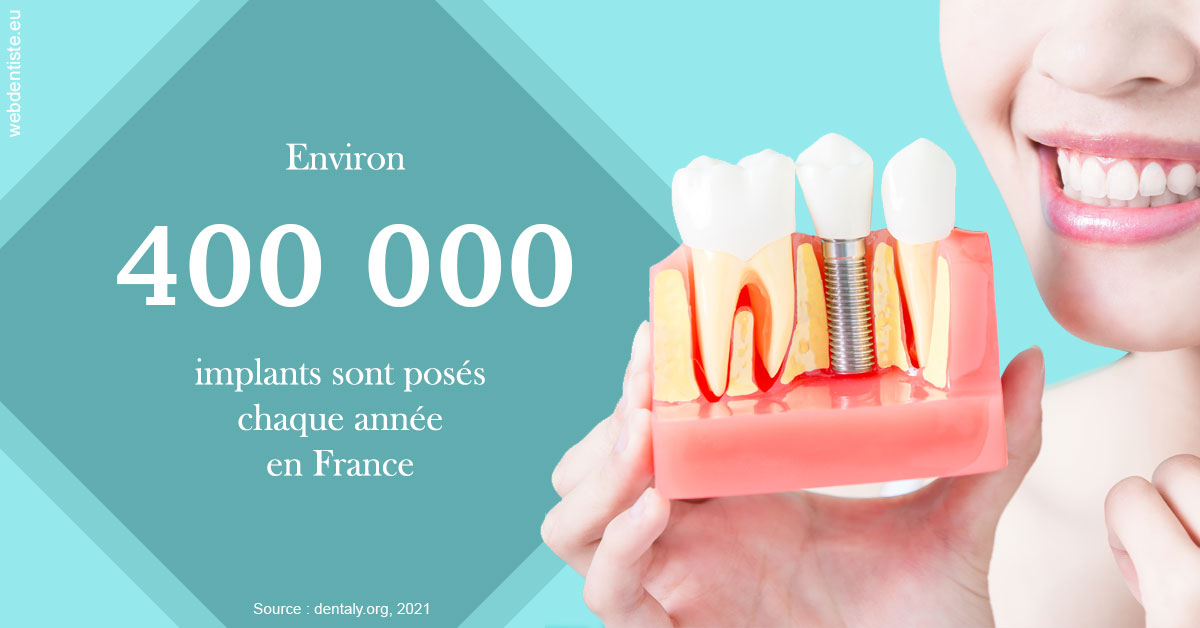 https://dr-aubry-marie-pierre.chirurgiens-dentistes.fr/Pose d'implants en France 2