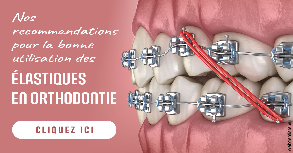 https://dr-aubry-marie-pierre.chirurgiens-dentistes.fr/Elastiques orthodontie 2